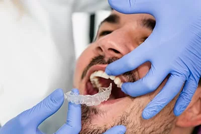 man having his clear aligners fitted